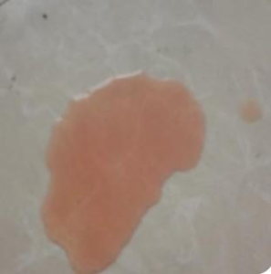 Male Cat Cystitis with Pink Urine: A Recovery Case